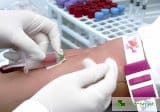 MPV кръвни изследвания: какво представляват и как могат да помогнат